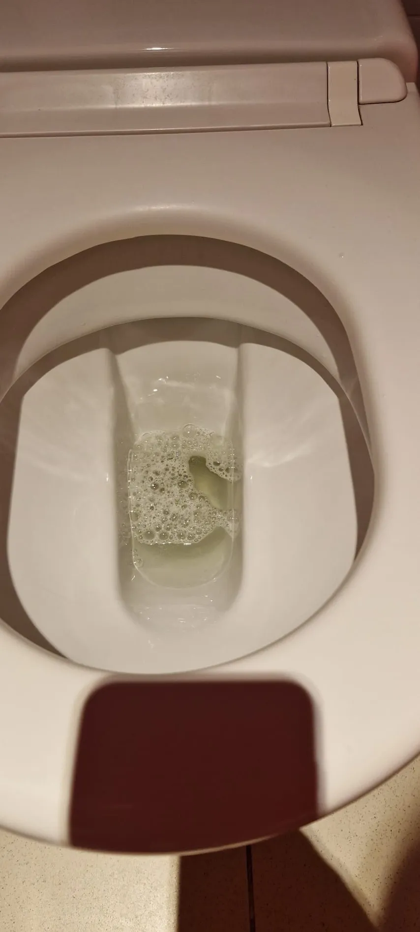 Sanitarije — uklanjanje kamenca — poslije